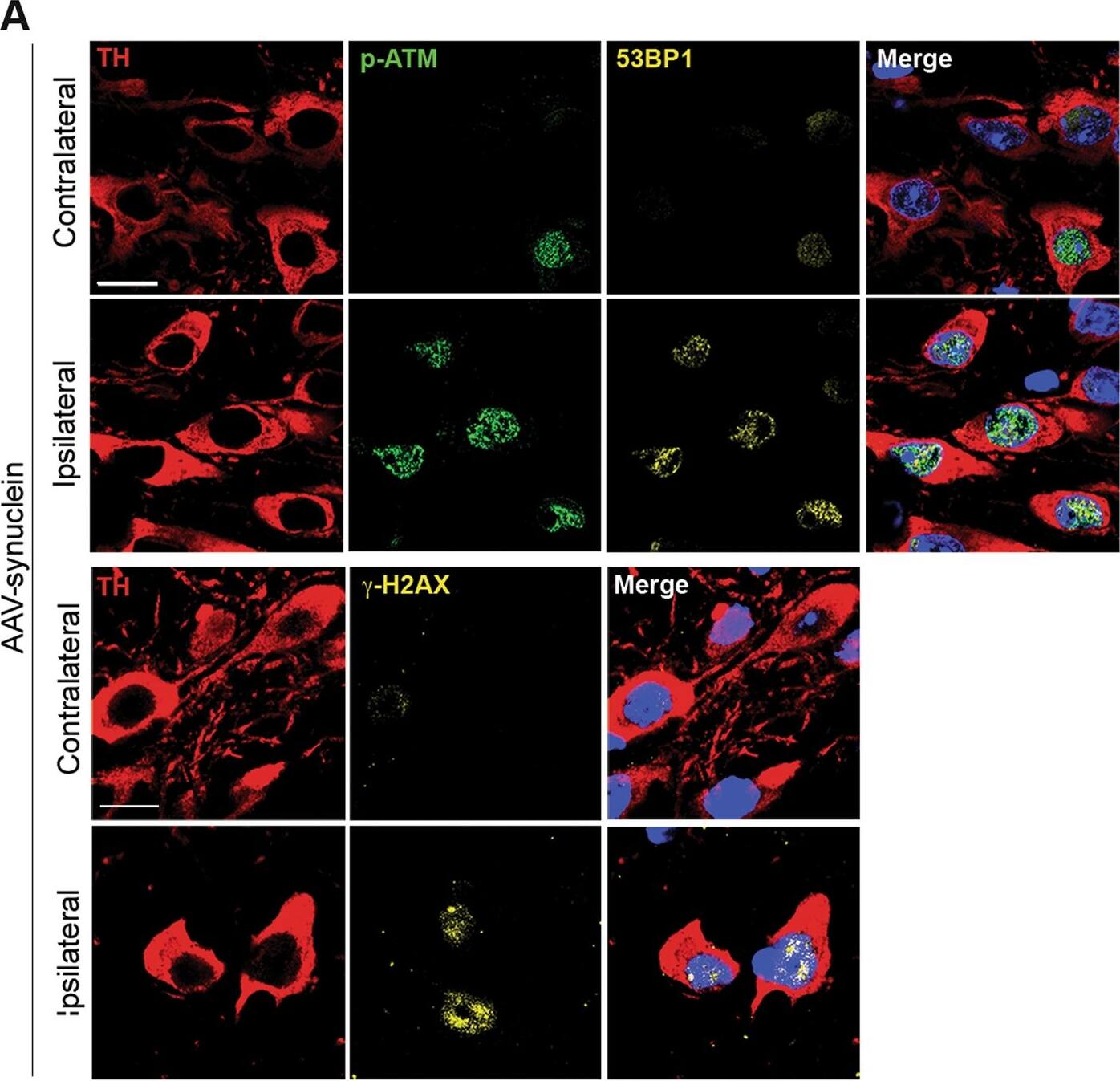 Tyrosine Hydroxylase Antibody