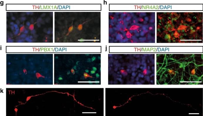 Tyrosine Hydroxylase Antibody