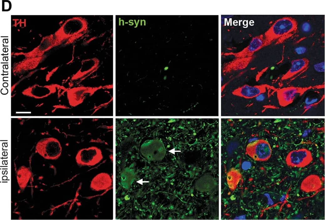Tyrosine Hydroxylase Antibody
