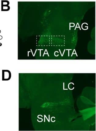 Tyrosine Hydroxylase Antibody