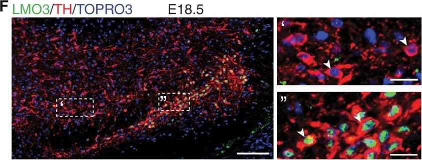 Tyrosine Hydroxylase Antibody