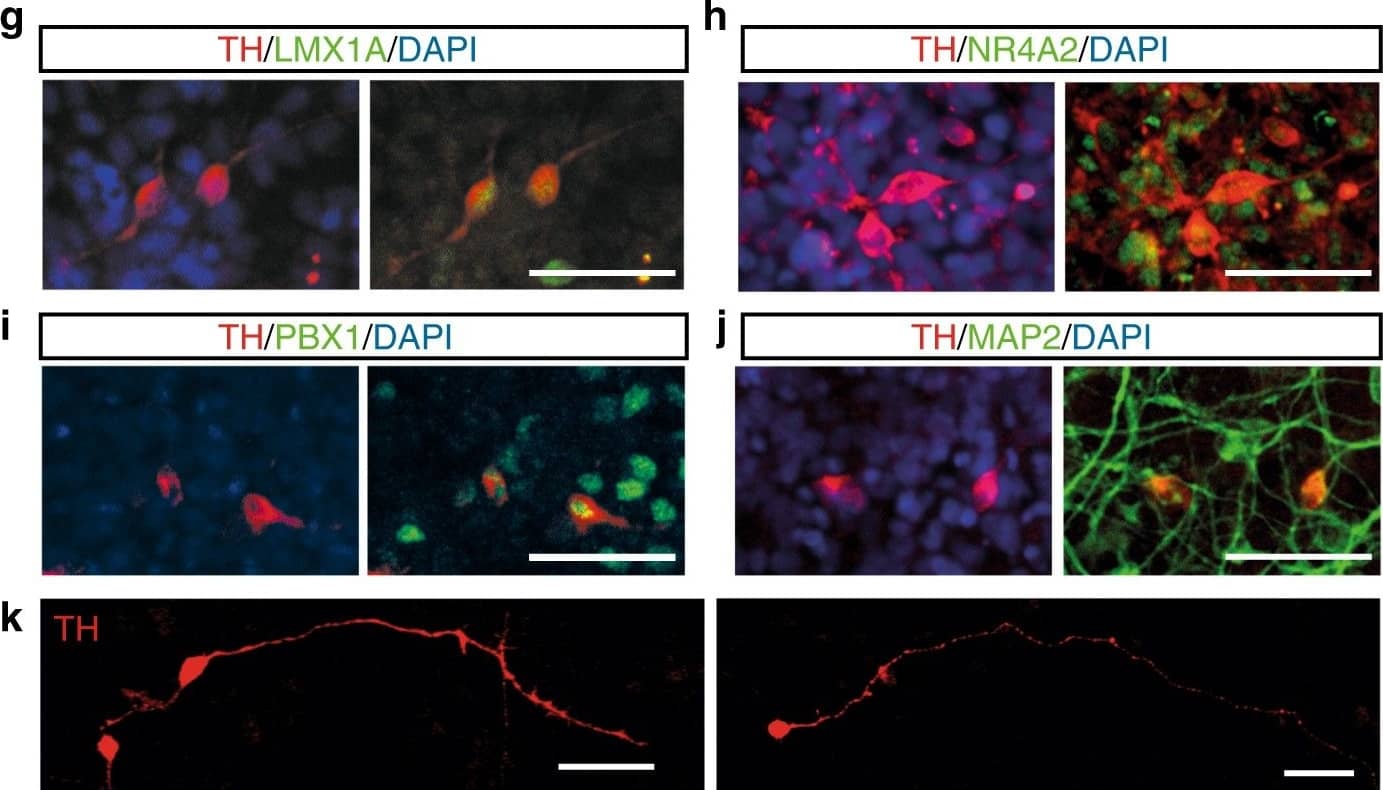 Tyrosine Hydroxylase Antibody