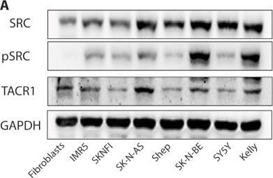 NK1R Antibody - BSA Free