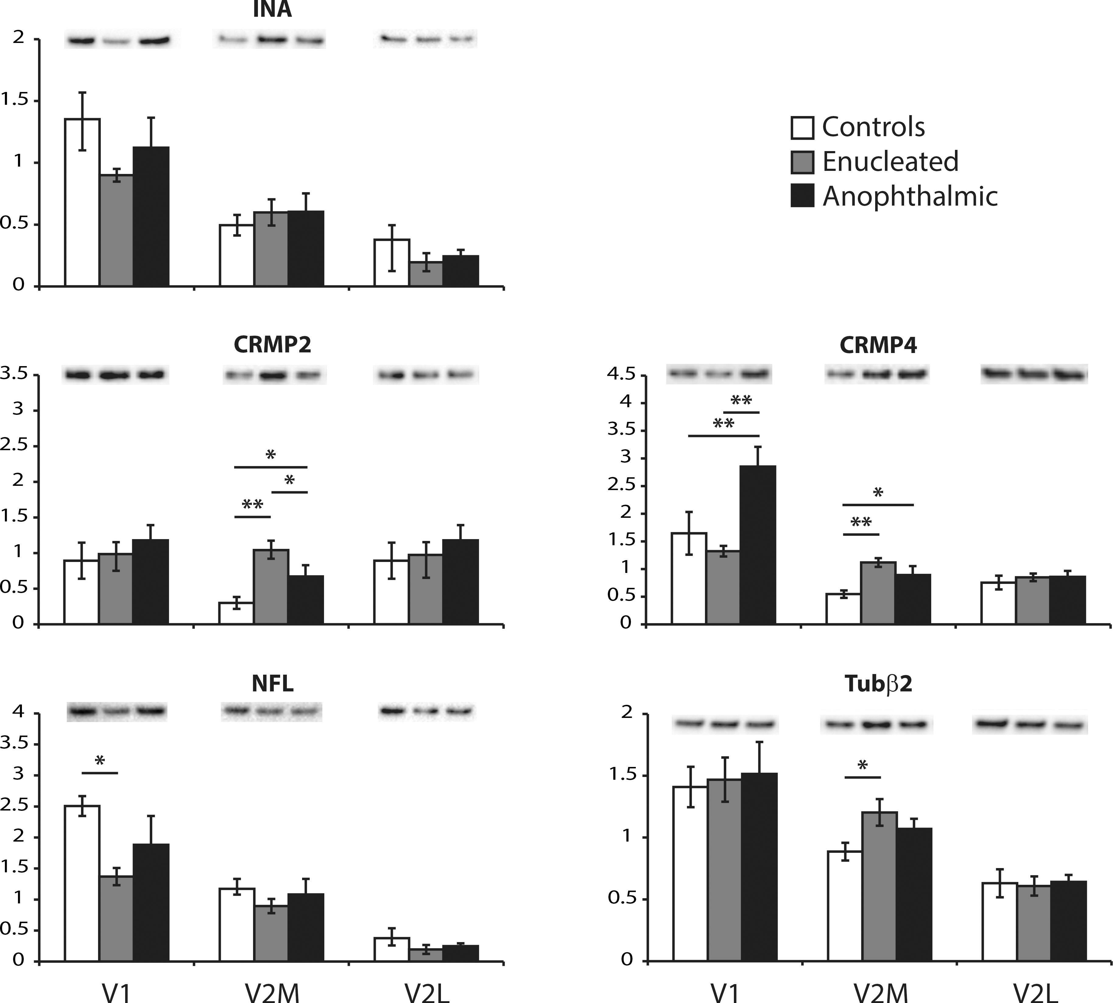 alpha-Internexin Antibody
