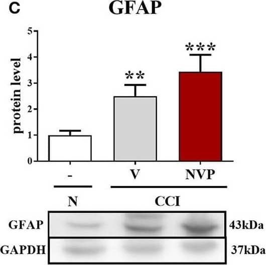 GFAP Antibody