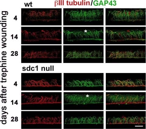 GAP-43 Antibody