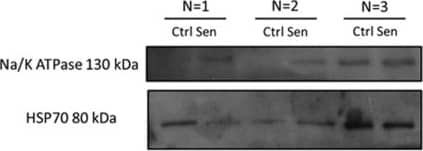 Sodium Potassium ATPase Alpha 1 Antibody (464.6)