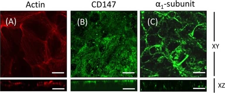 Sodium Potassium ATPase Alpha 1 Antibody (464.6)