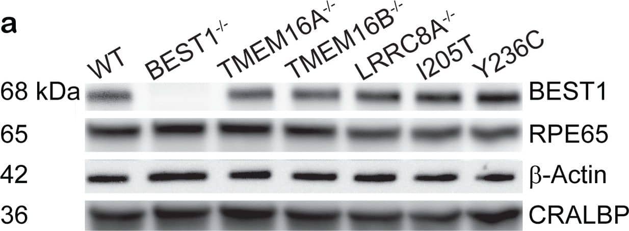 Bestrophin 1 Antibody (E6-6) - BSA Free