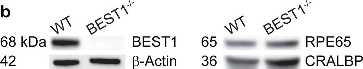 Bestrophin 1 Antibody (E6-6) - BSA Free