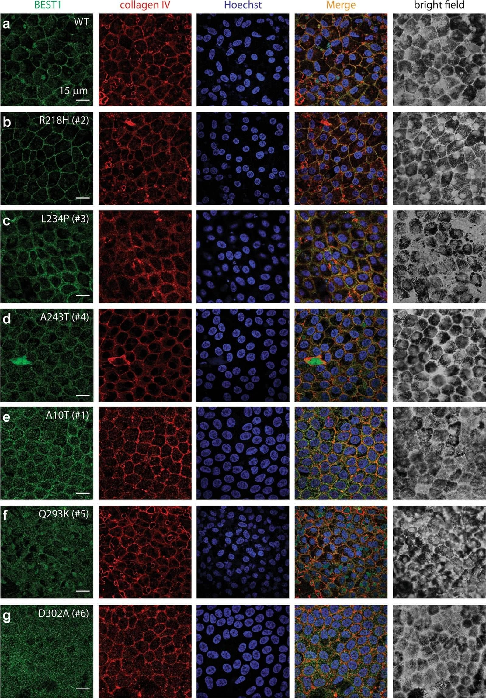 Bestrophin 1 Antibody (E6-6) - BSA Free