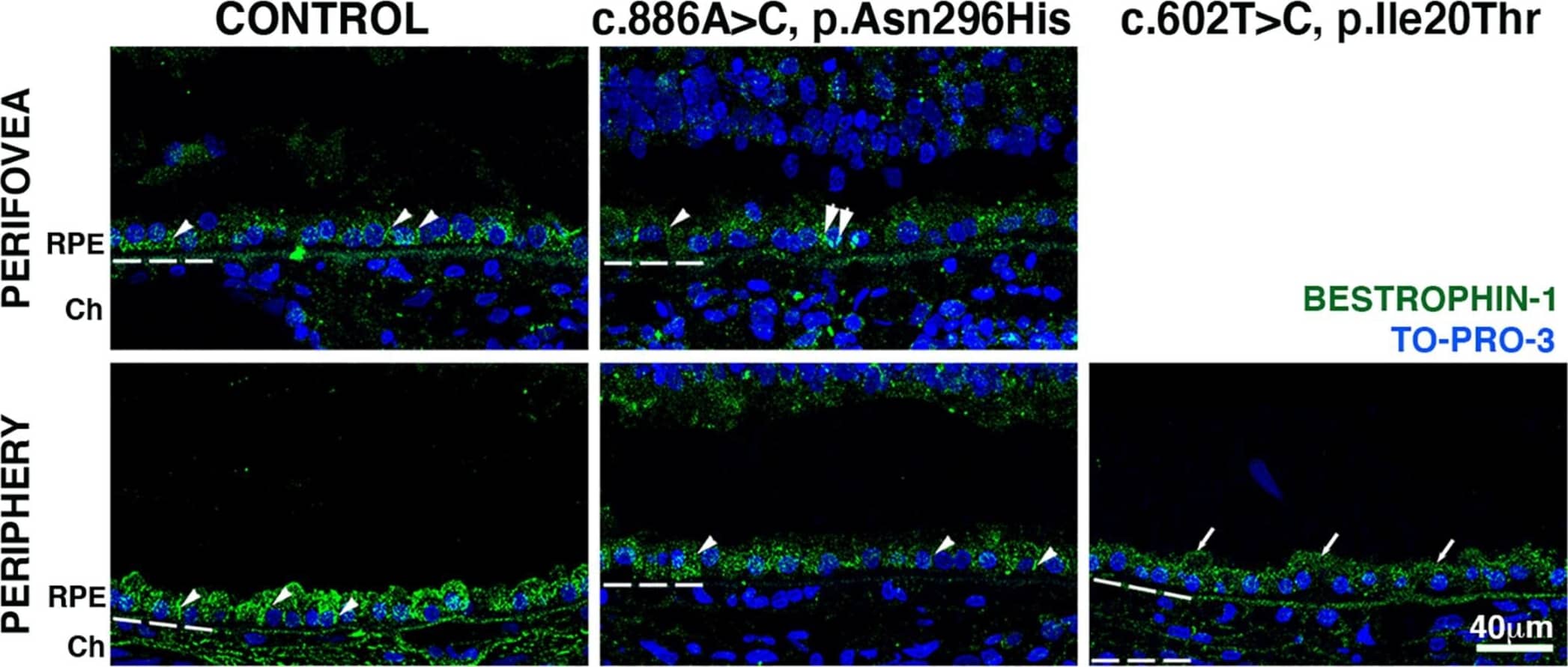 Bestrophin 1 Antibody (E6-6) - BSA Free