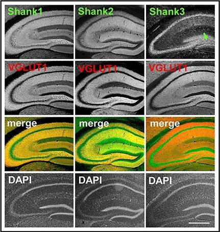 SHANK1 Antibody - BSA Free