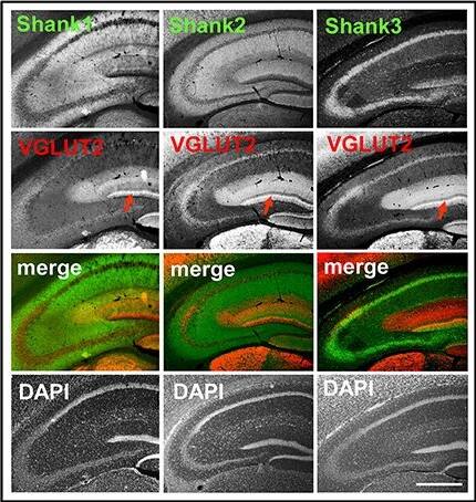 SHANK1 Antibody - BSA Free
