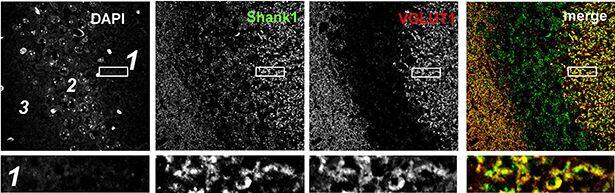 SHANK1 Antibody - BSA Free
