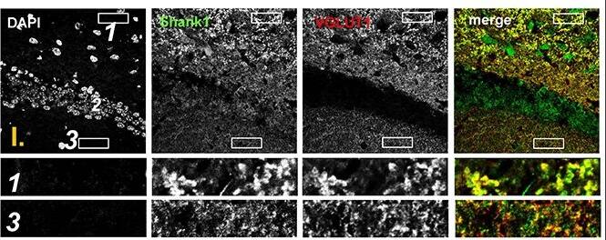 SHANK1 Antibody - BSA Free