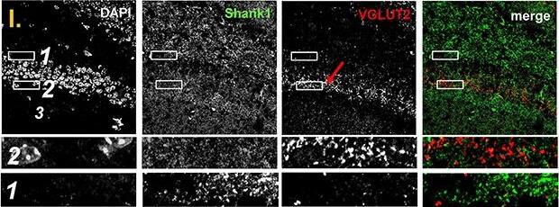 SHANK1 Antibody - BSA Free
