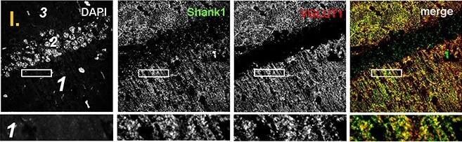 SHANK1 Antibody - BSA Free