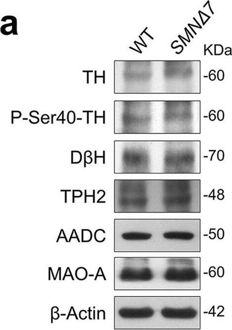 Dopa Decarboxylase/DDC Antibody - Azide Free