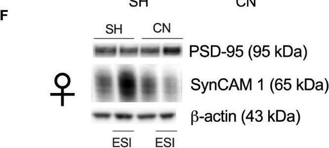 IGSF4A/SynCAM1/CADM1 Antibody - BSA Free