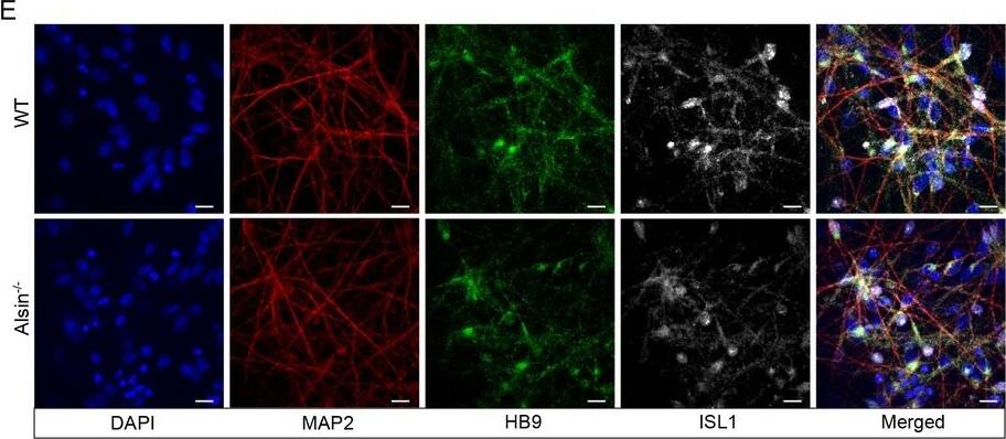 MAP2 Antibody BSA Free NB300 213 By Novus Part Of Bio Techne