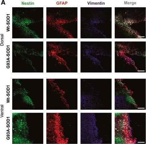 Vimentin Antibody