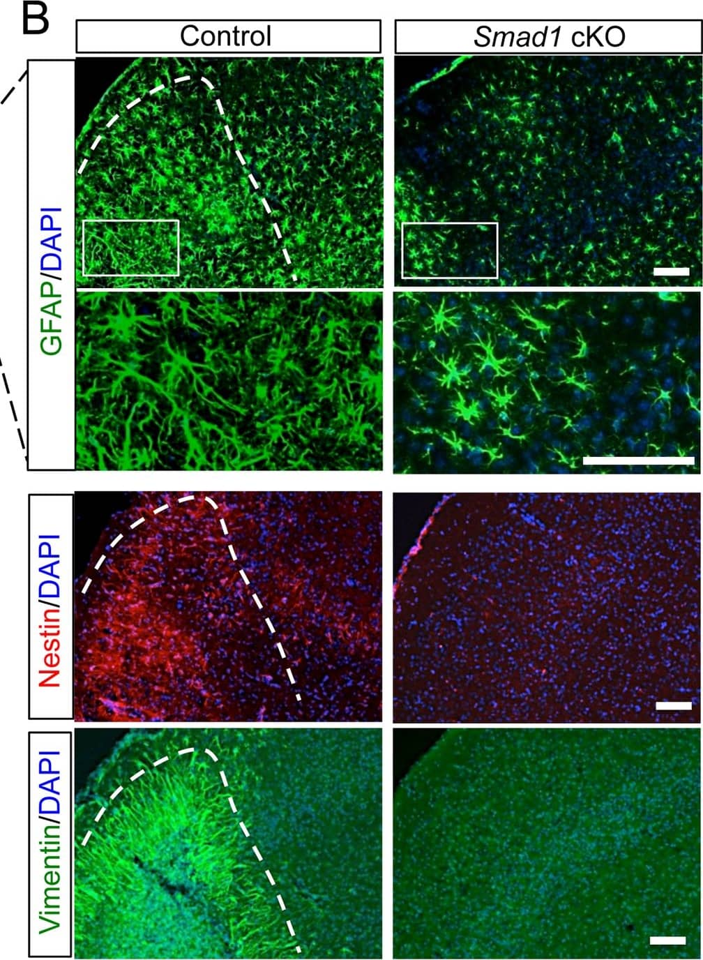 Vimentin Antibody