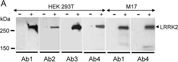 LRRK2 Antibody - BSA Free