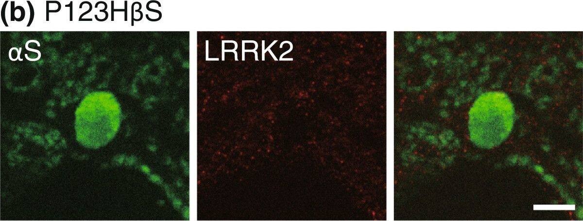 LRRK2 Antibody - BSA Free
