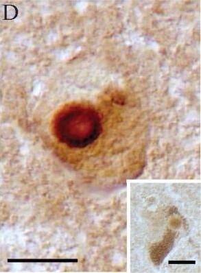 LRRK2 Antibody - BSA Free