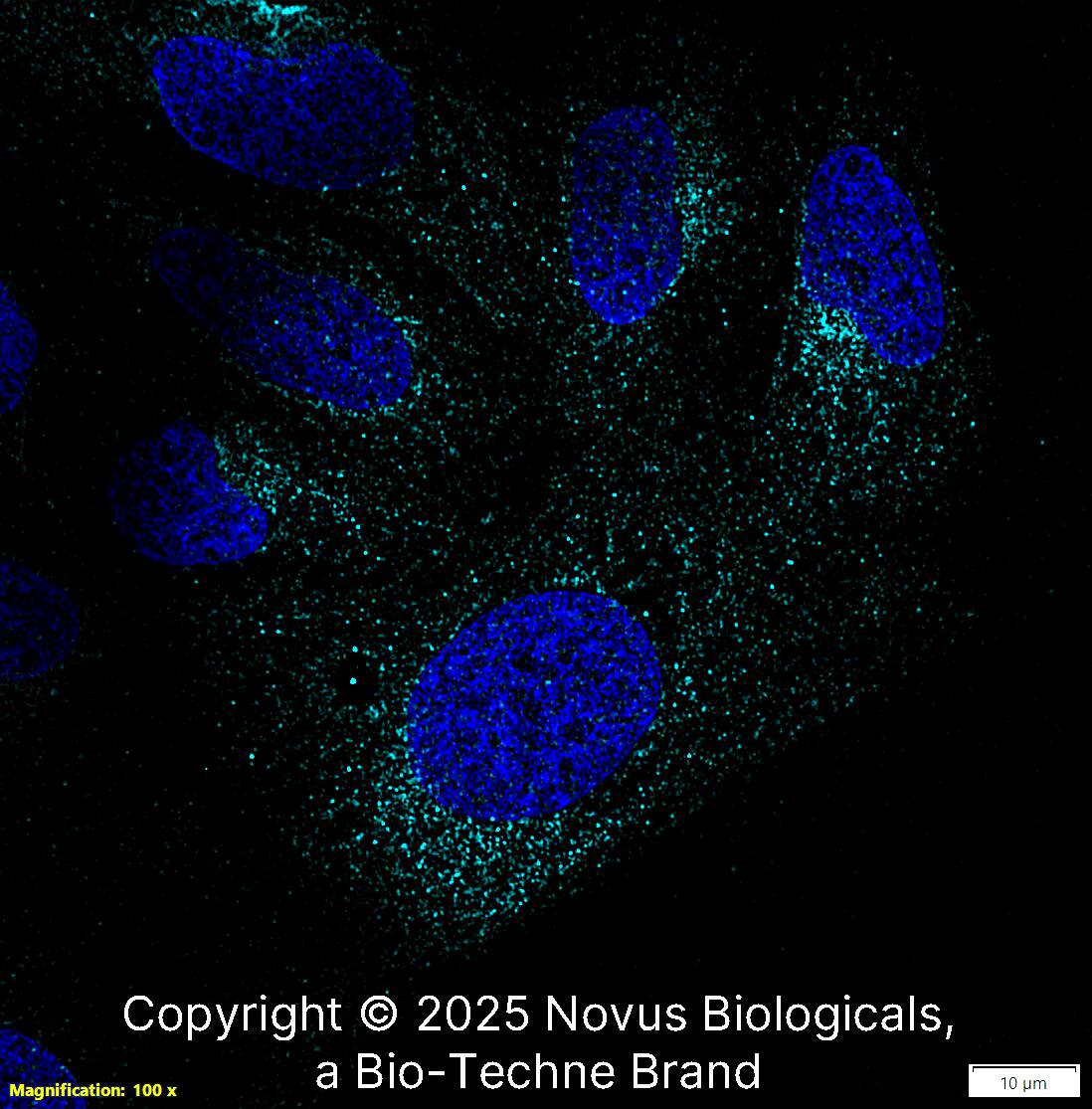 LRRK2 Antibody [Alexa Fluor® 647]