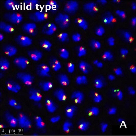 Fibrillarin Antibody (38F3)