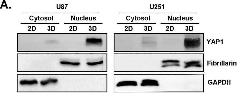 Fibrillarin Antibody (38F3)