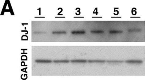 Park7/DJ-1 Antibody