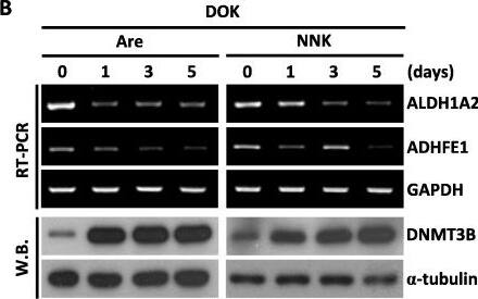 DNMT3B Antibody
