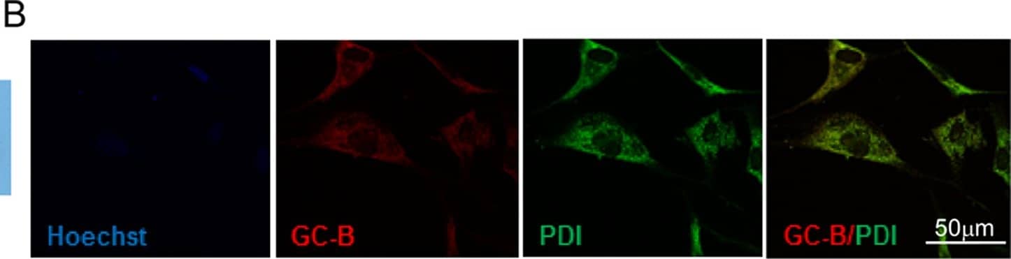 Protein Disulfide Isomerase/P4HB Antibody (RL90)