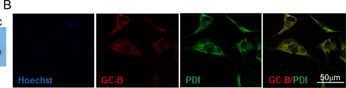 Protein Disulfide Isomerase/P4HB Antibody (RL90)