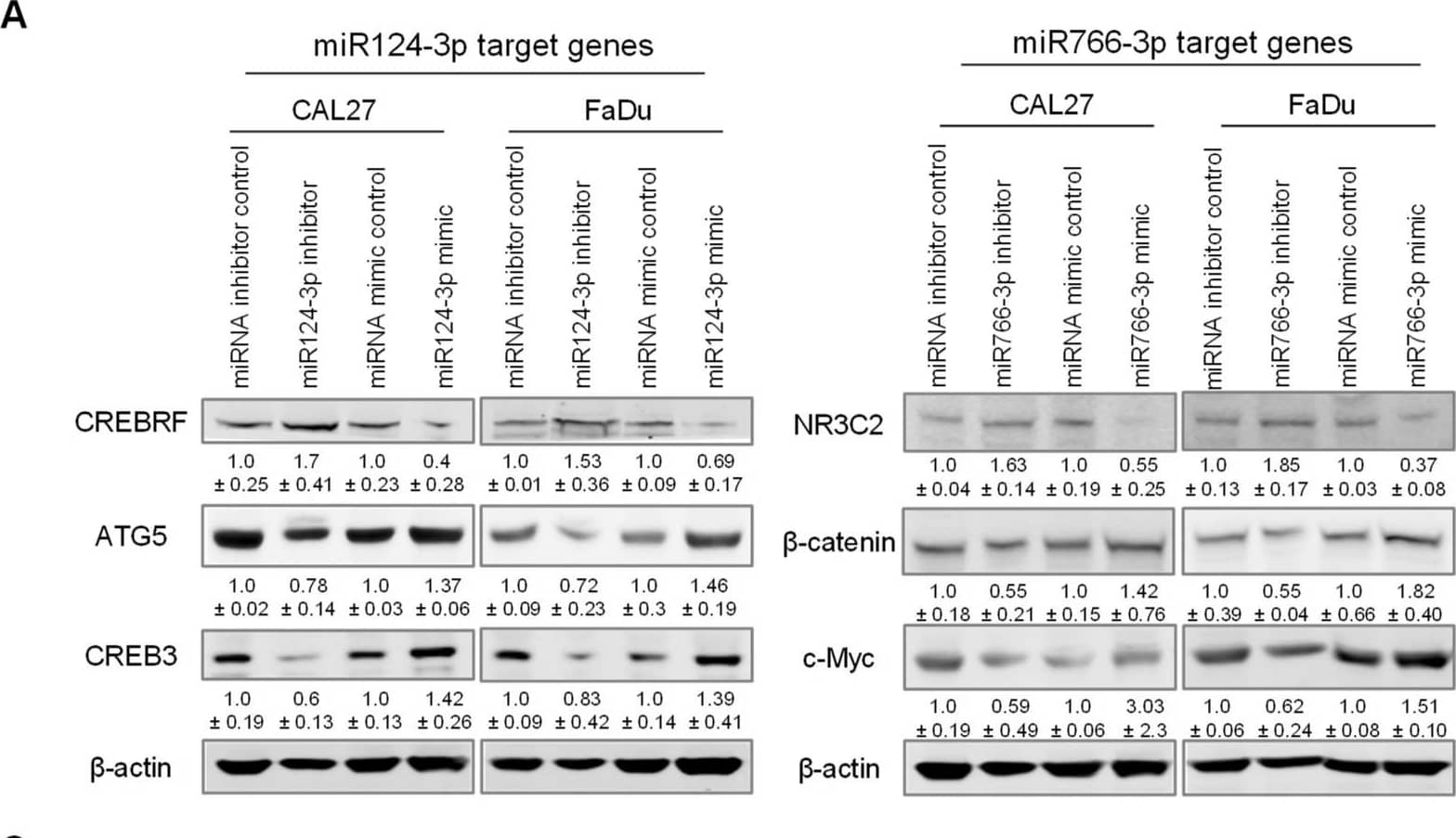 Mineralocorticoid R/NR3C2 Antibody (H10E4C9F) - BSA Free