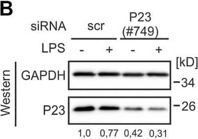 p23/PTGES3 Antibody (JJ3)