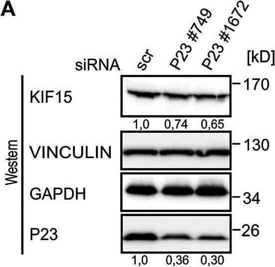p23/PTGES3 Antibody (JJ3)