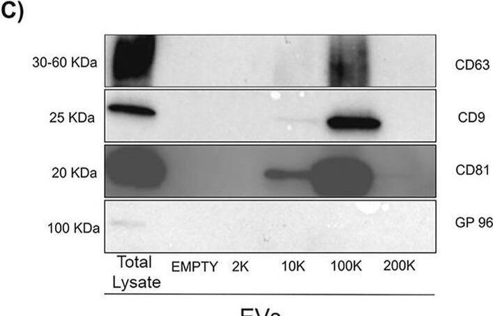 gp96/HSP90B1/GRP94 Antibody (9G10)