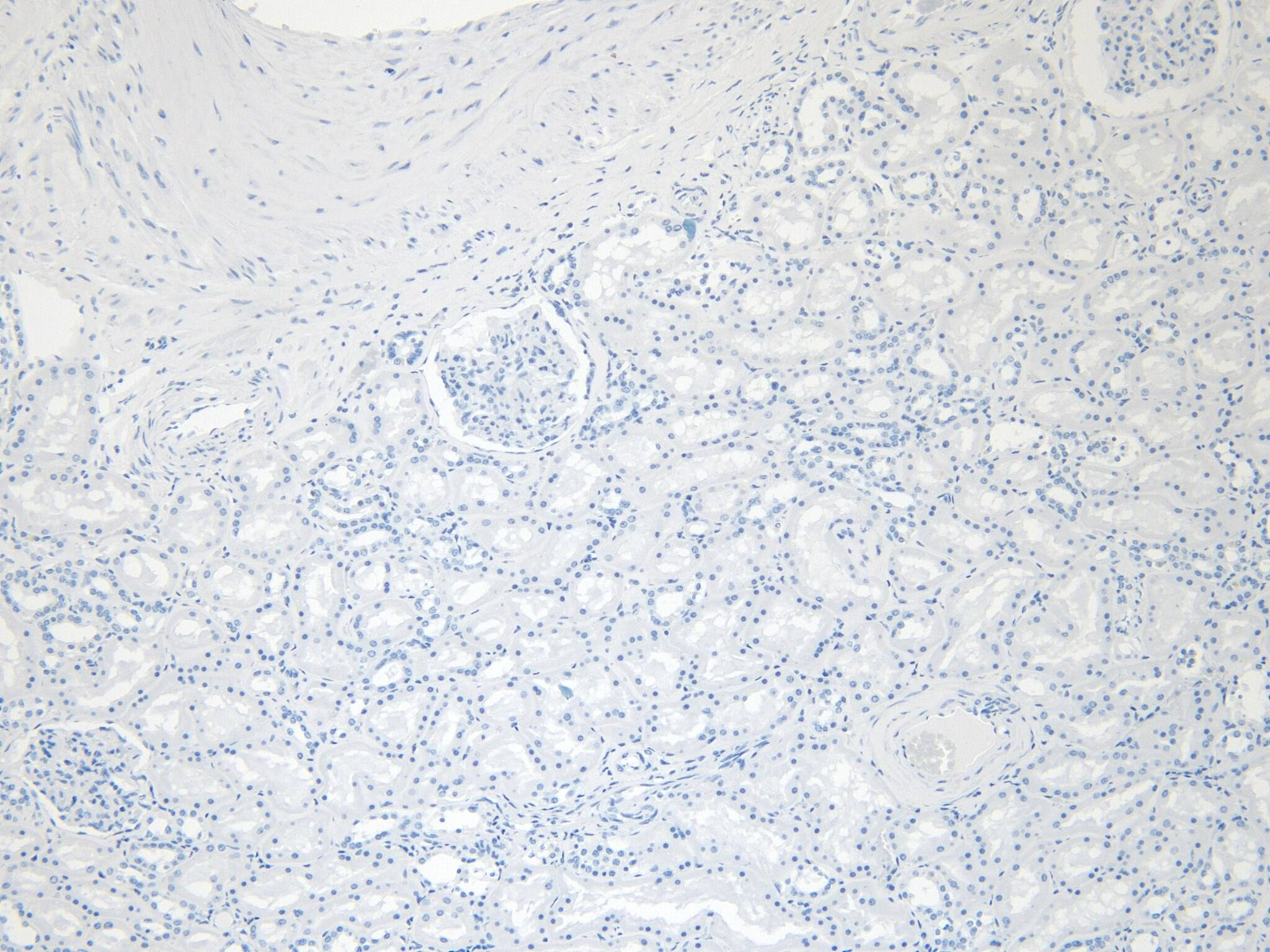 Eps8 Antibody