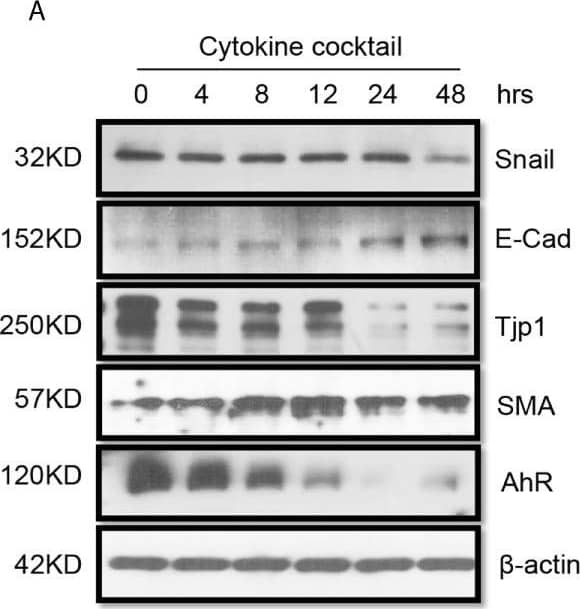 alpha-Smooth Muscle Actin Antibody