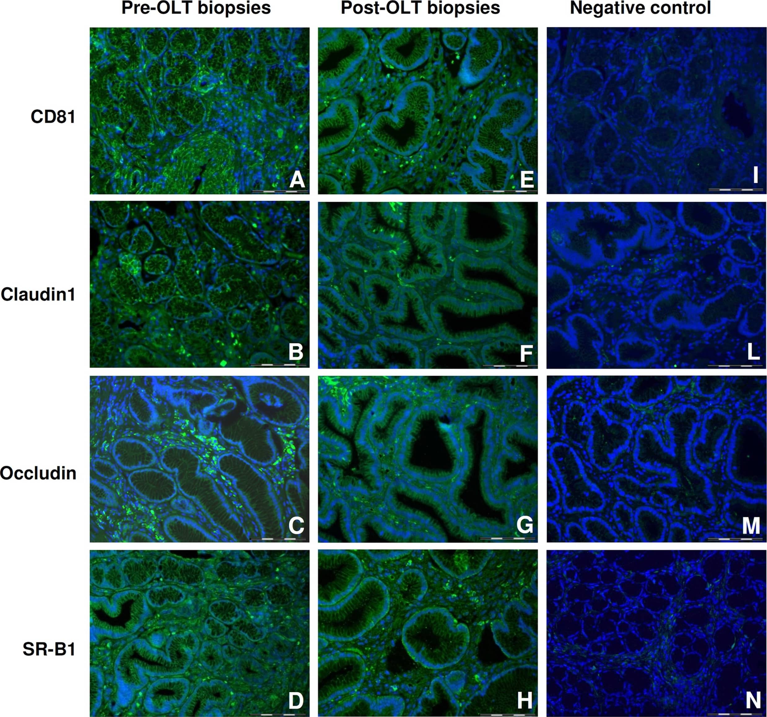 SR-BI Antibody - BSA Free