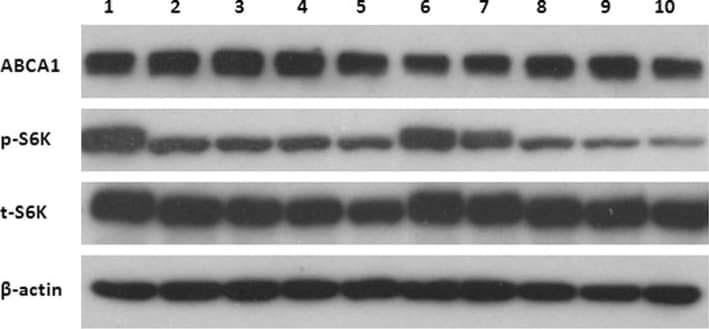 ABCA1 Antibody - BSA Free