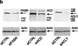 Fatty Acid Synthase/FASN Antibody