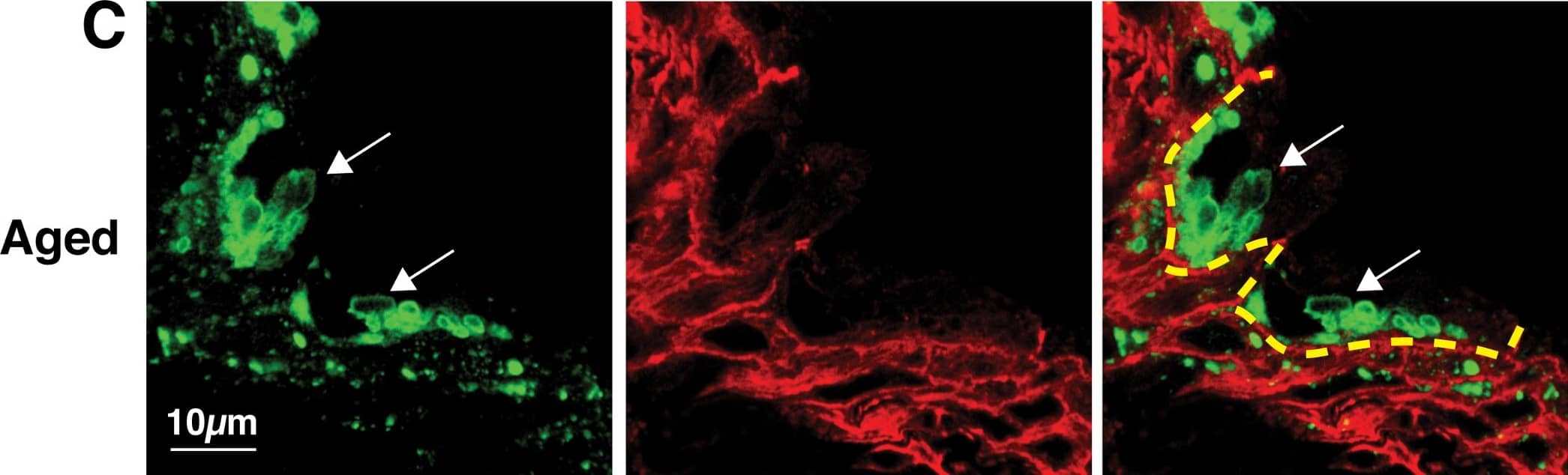LIMPII/SR-B2 Antibody