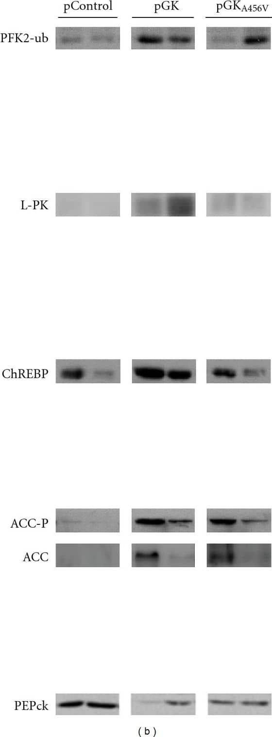 CHREBP Antibody - BSA Free