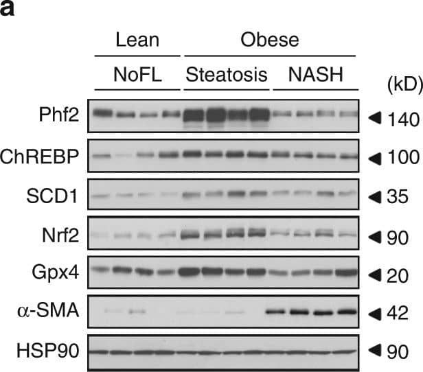 CHREBP Antibody - BSA Free