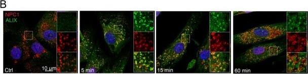 Niemann-Pick C1 Antibody - BSA Free